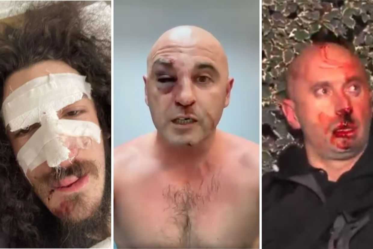 From left to right: Zviad Maisashvili, Levan Khabeishvili, and Guram Rogava after being brutally beaten by police. Photos via social media.