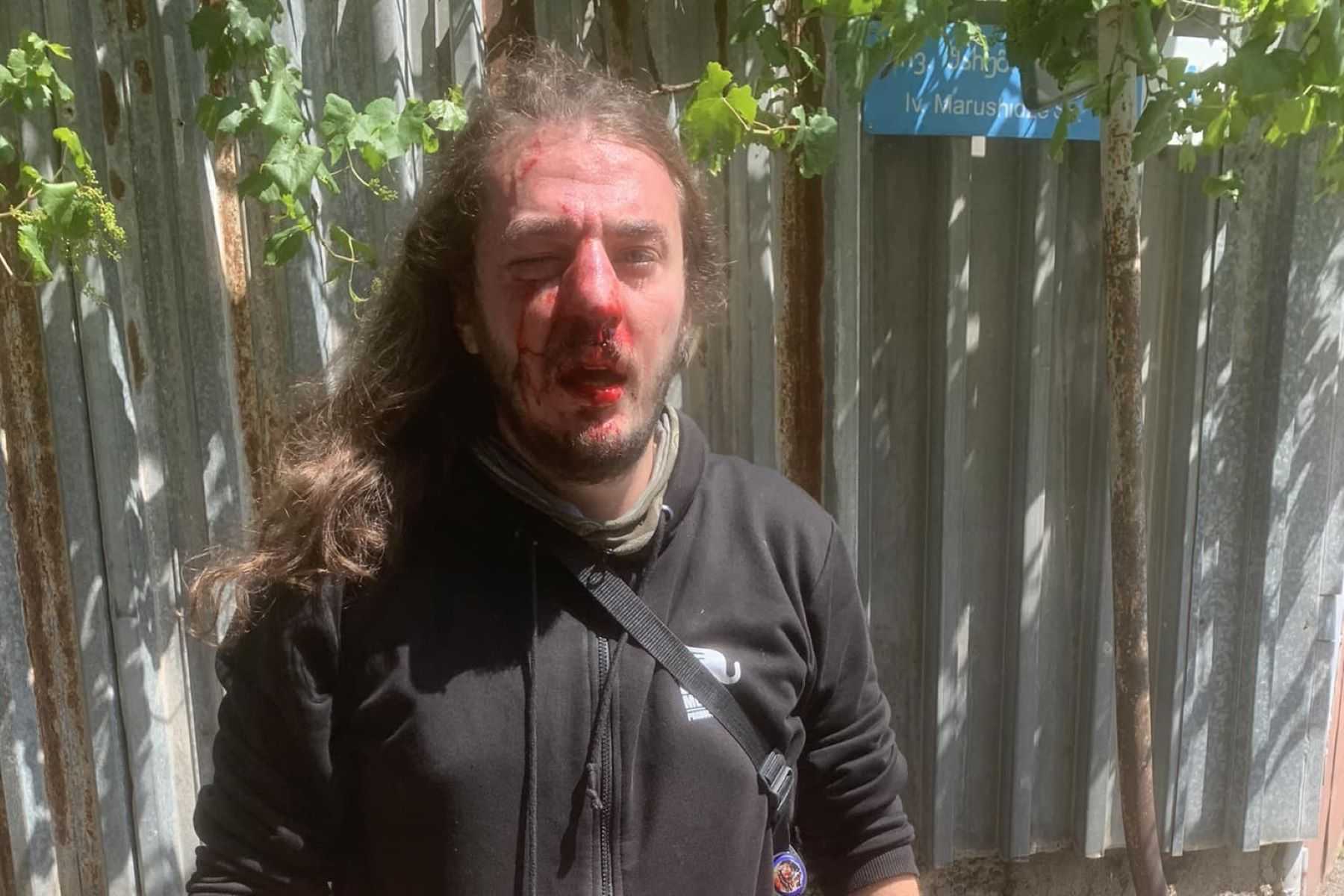 Activist Zuka Berdzenishvili following the attack outside his home. Image via Salome Nikolaishvili.