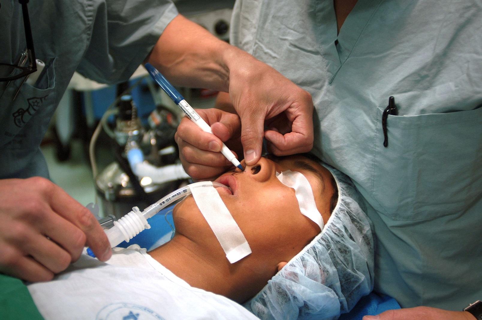 North Ossetian Prosecutor to probe plastic surgery death