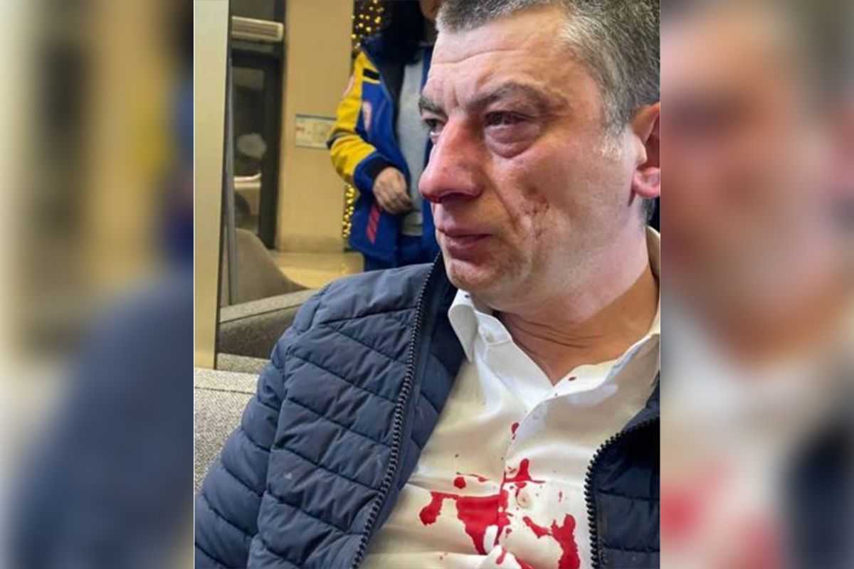 Georgian opposition leader Giorgi Gakharia after being attacked at the Sheraton Hotel in Batumi. Photo: social media.