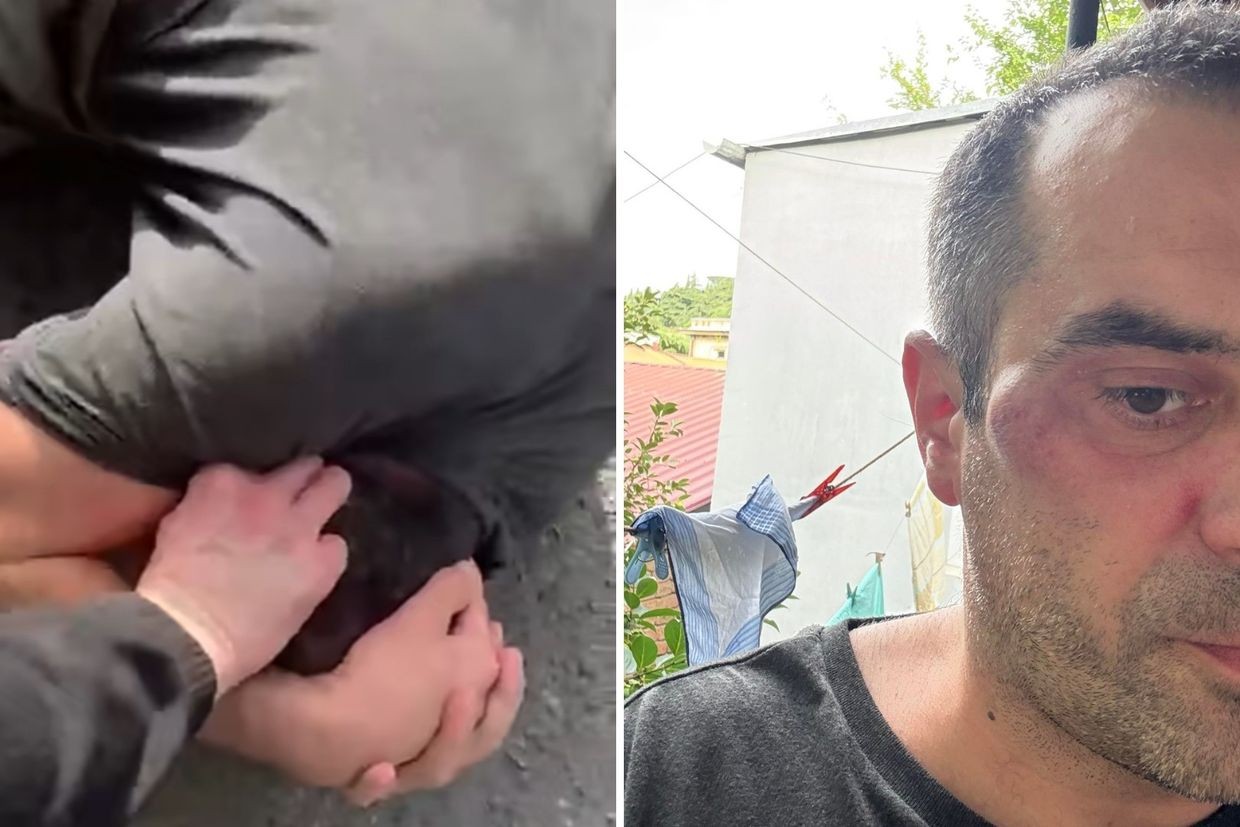 Left: Screengrab from the video of the attack on Vano Tarkhnishvili. Right: Tarkhnishvili after the attack.